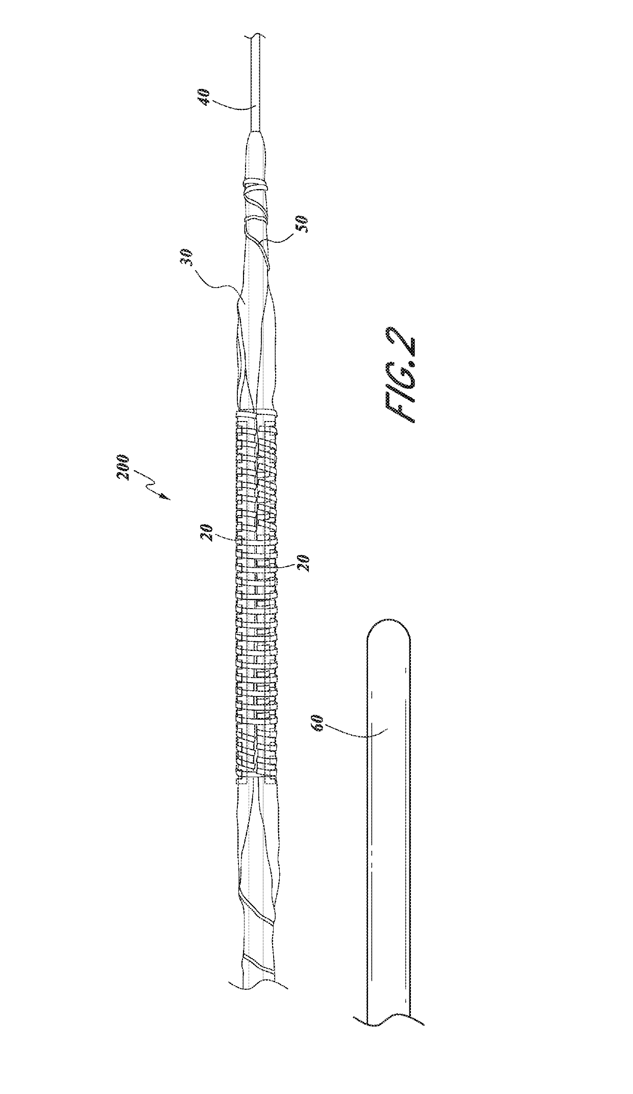 Serration balloon