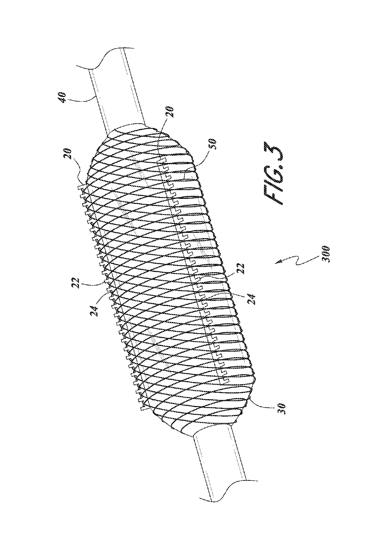 Serration balloon