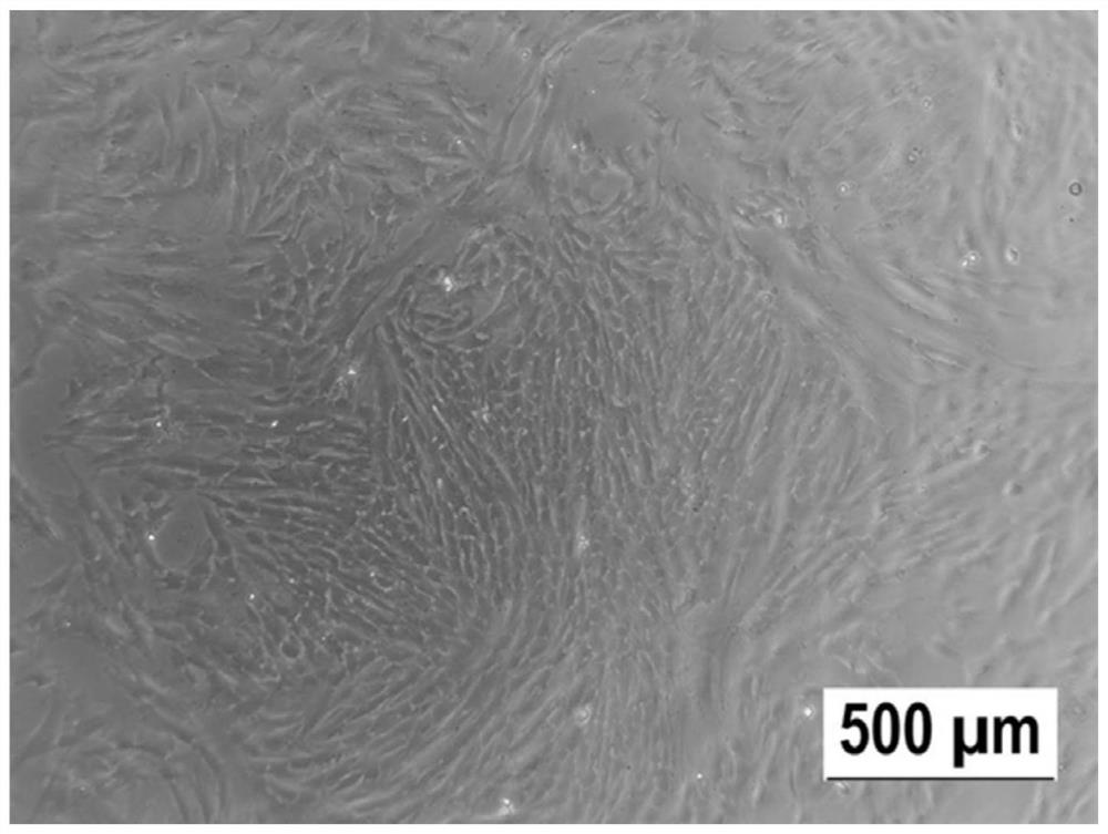 Exosome and hyaluronic acid combined wound dressing, and preparation method and application thereof