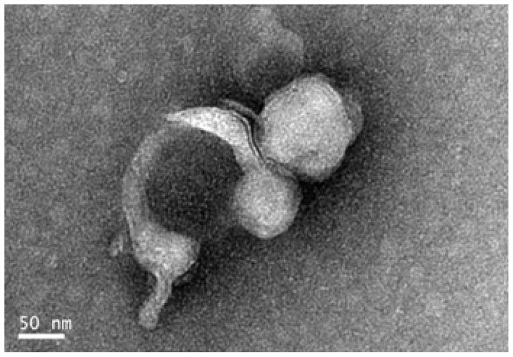 Exosome and hyaluronic acid combined wound dressing, and preparation method and application thereof