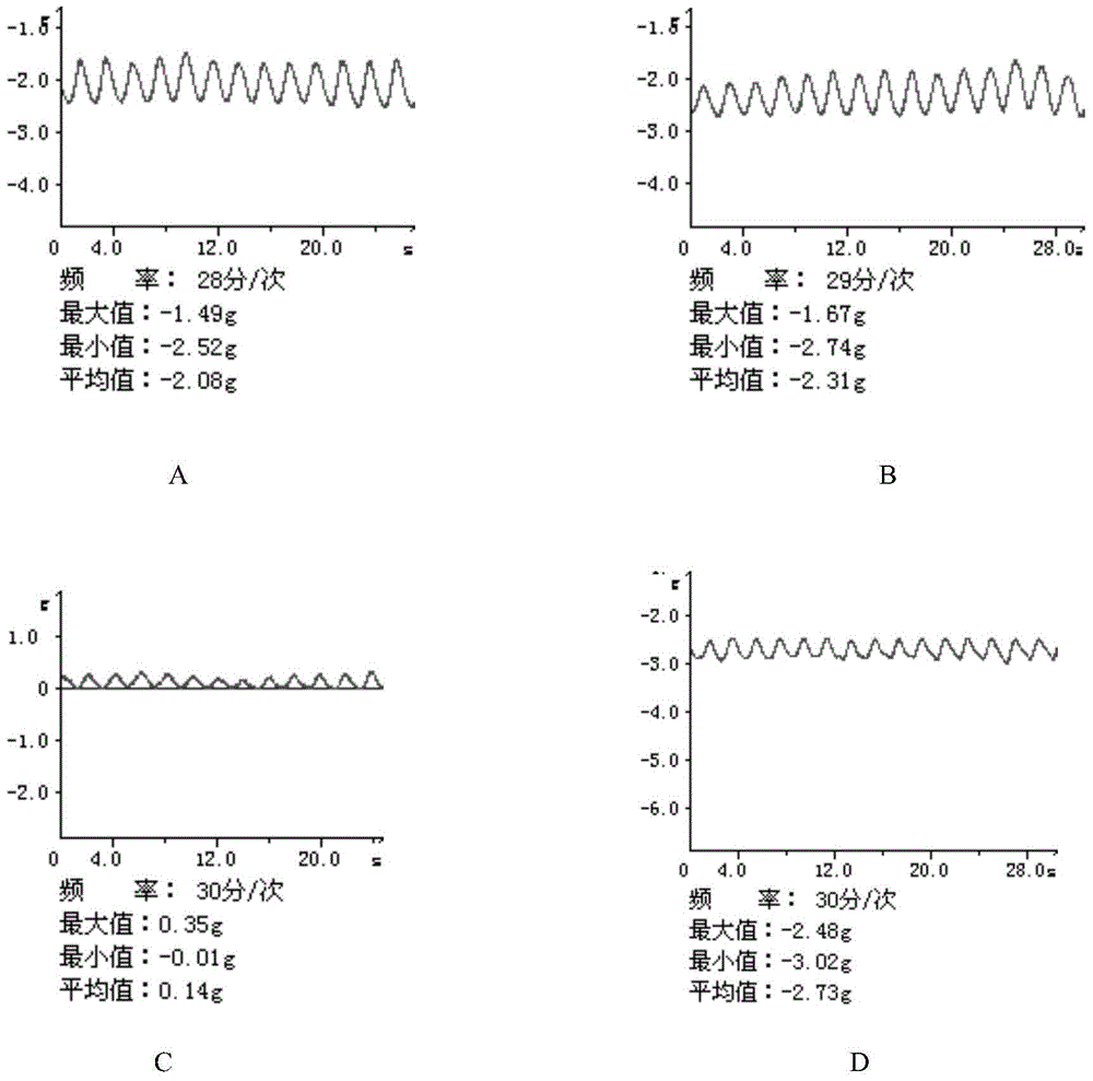 Bullfrog slow-excitation peptide, coded nucleic acid thereof and application