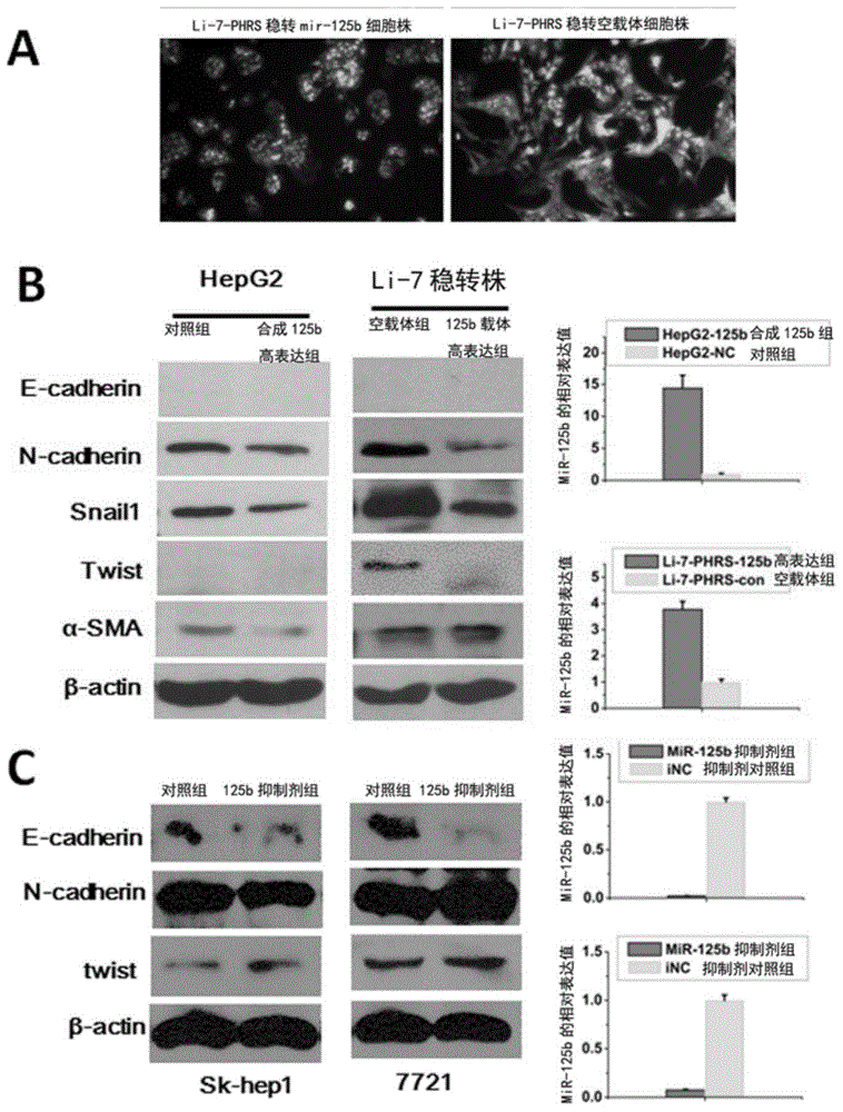 Application of miR-125b in antineoplastics