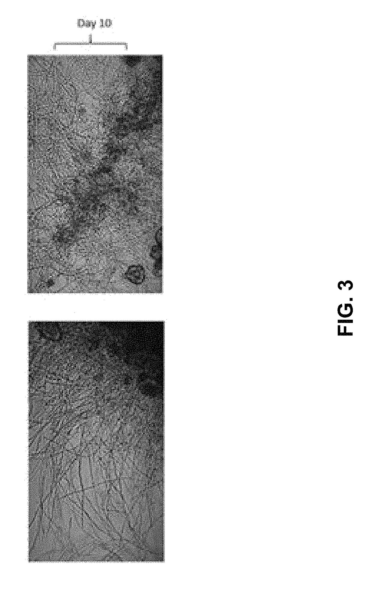 Methods for the production and use of myceliated high protein food compositions