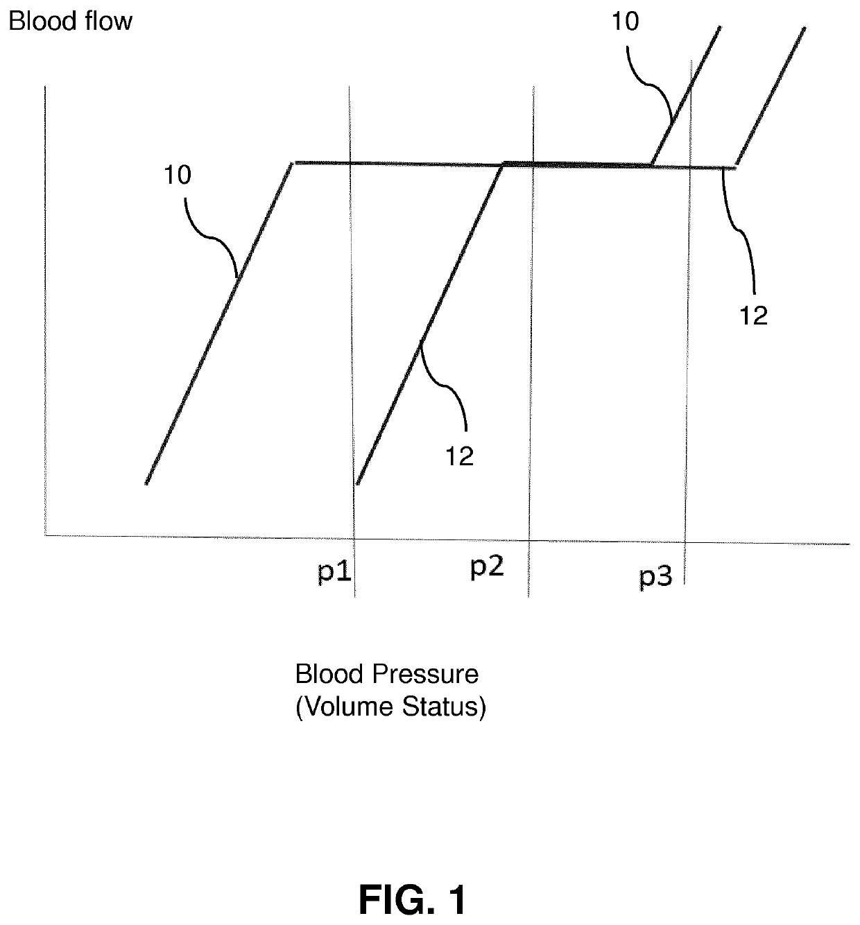 Monitoring blood distribution in a subject