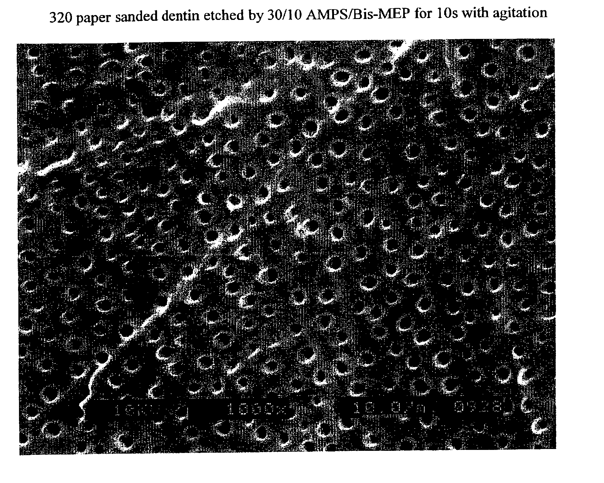 Stable self-etching primer and adhesive bonding resin compositions, systems, and methods