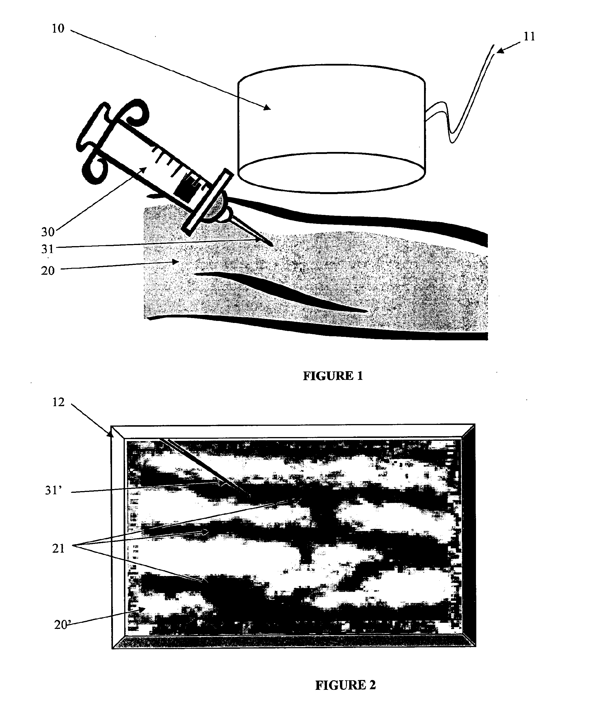 Apparatus and method for non-invasively locating blood vessels