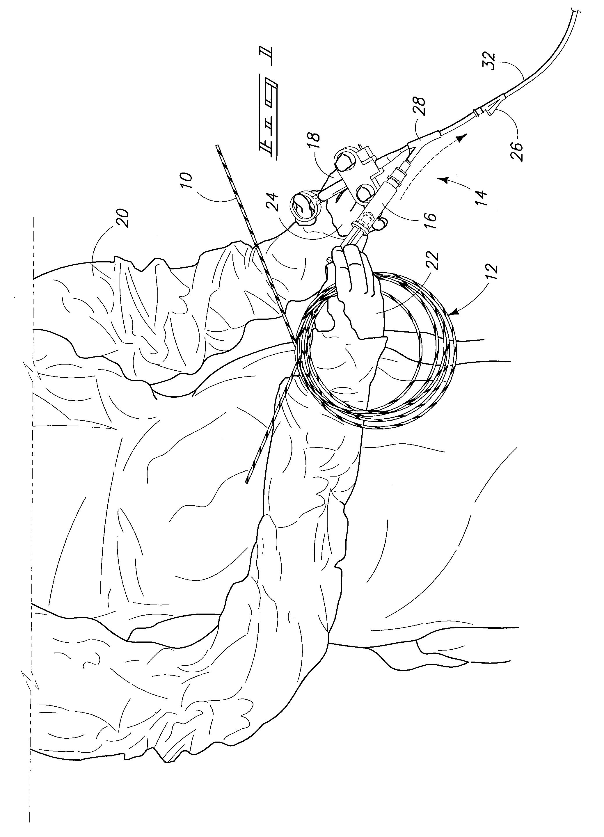 Article for Retaining Components of an Endoscopic Retrograde Cholangio-Pancreatography Delivery System