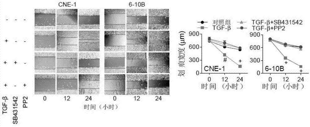 Flotilli-2 as target in screening nasopharyngeal carcinoma metastasis inhibiting drugs and application of Flotilli-2