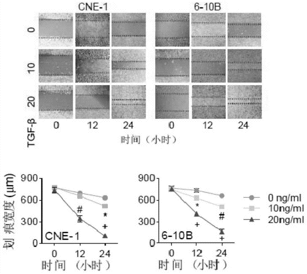 Flotilli-2 as target in screening nasopharyngeal carcinoma metastasis inhibiting drugs and application of Flotilli-2