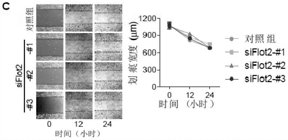 Flotilli-2 as target in screening nasopharyngeal carcinoma metastasis inhibiting drugs and application of Flotilli-2