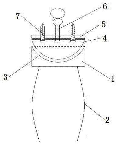 Artificial total wrist joint prosthesis made of nickel-titanium memory metal