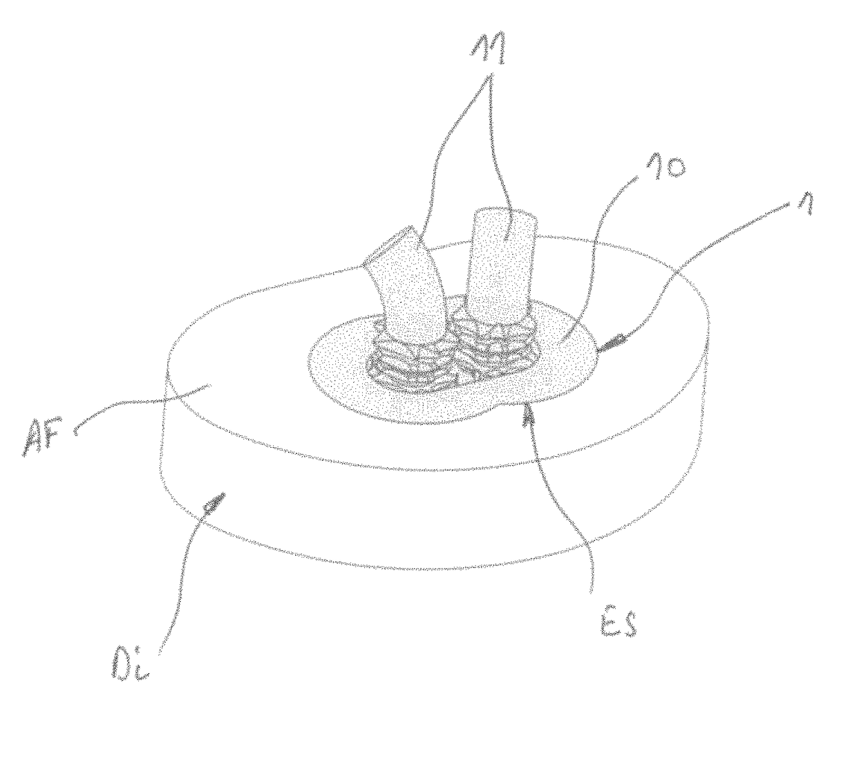 Silicone nucleus implants