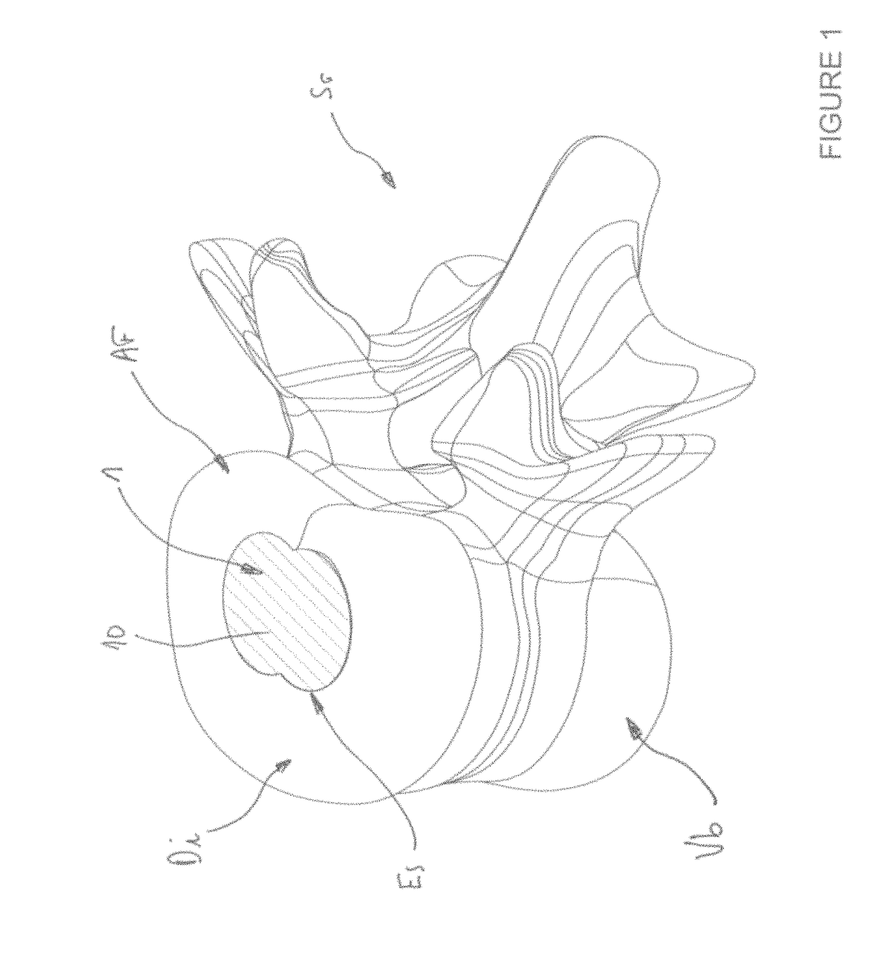 Silicone nucleus implants