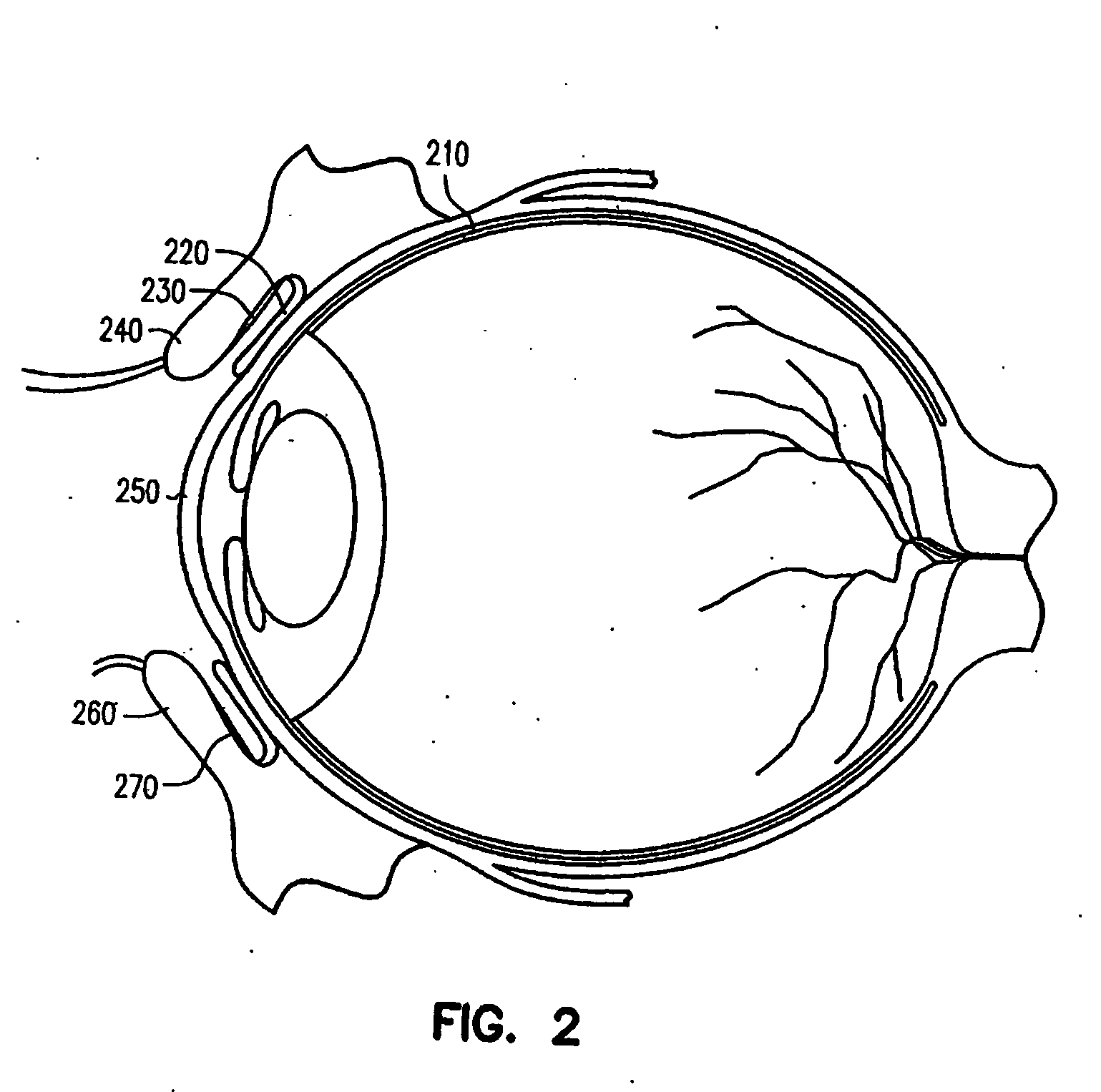 Ocular delivery of polymeric delivery formulations