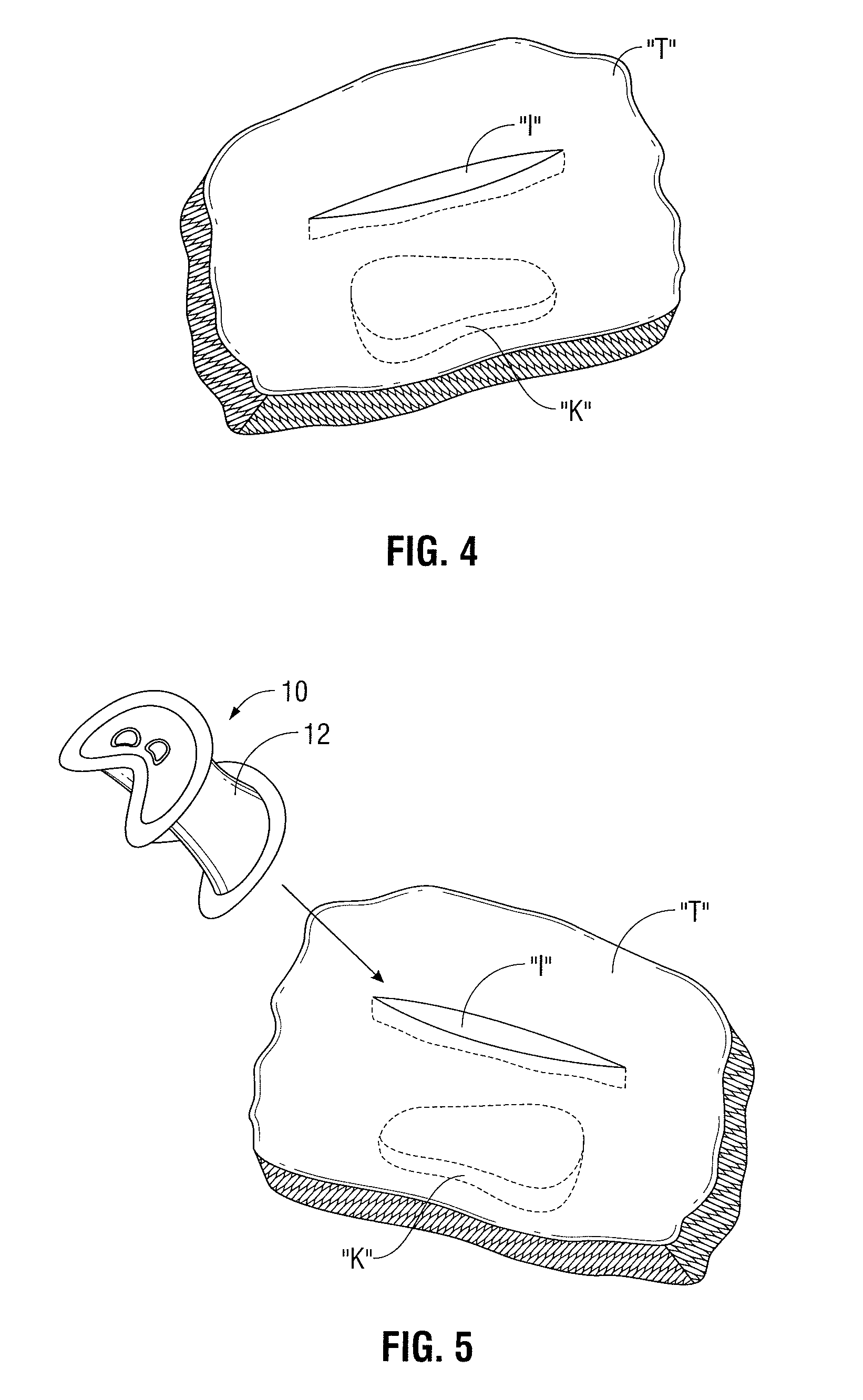 Seal port with blood collector