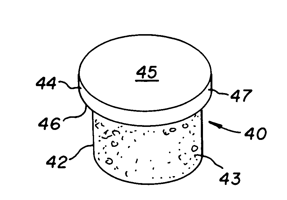 Cartilage allograft plug