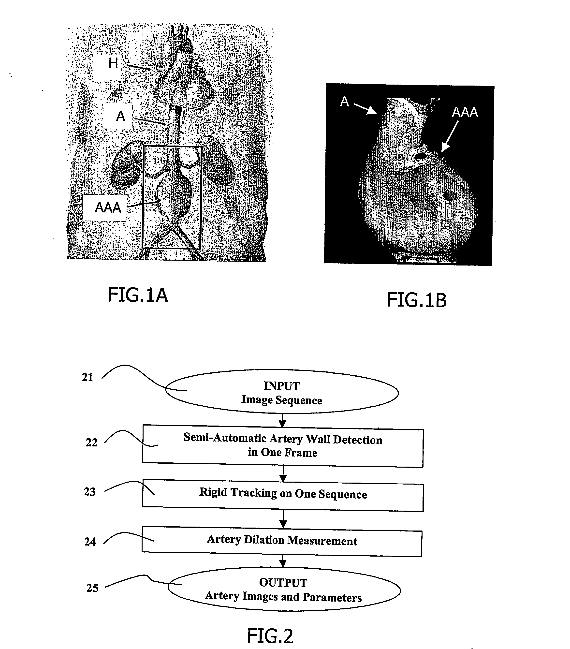 Ultrasonic apparatus for estimating artery parameters