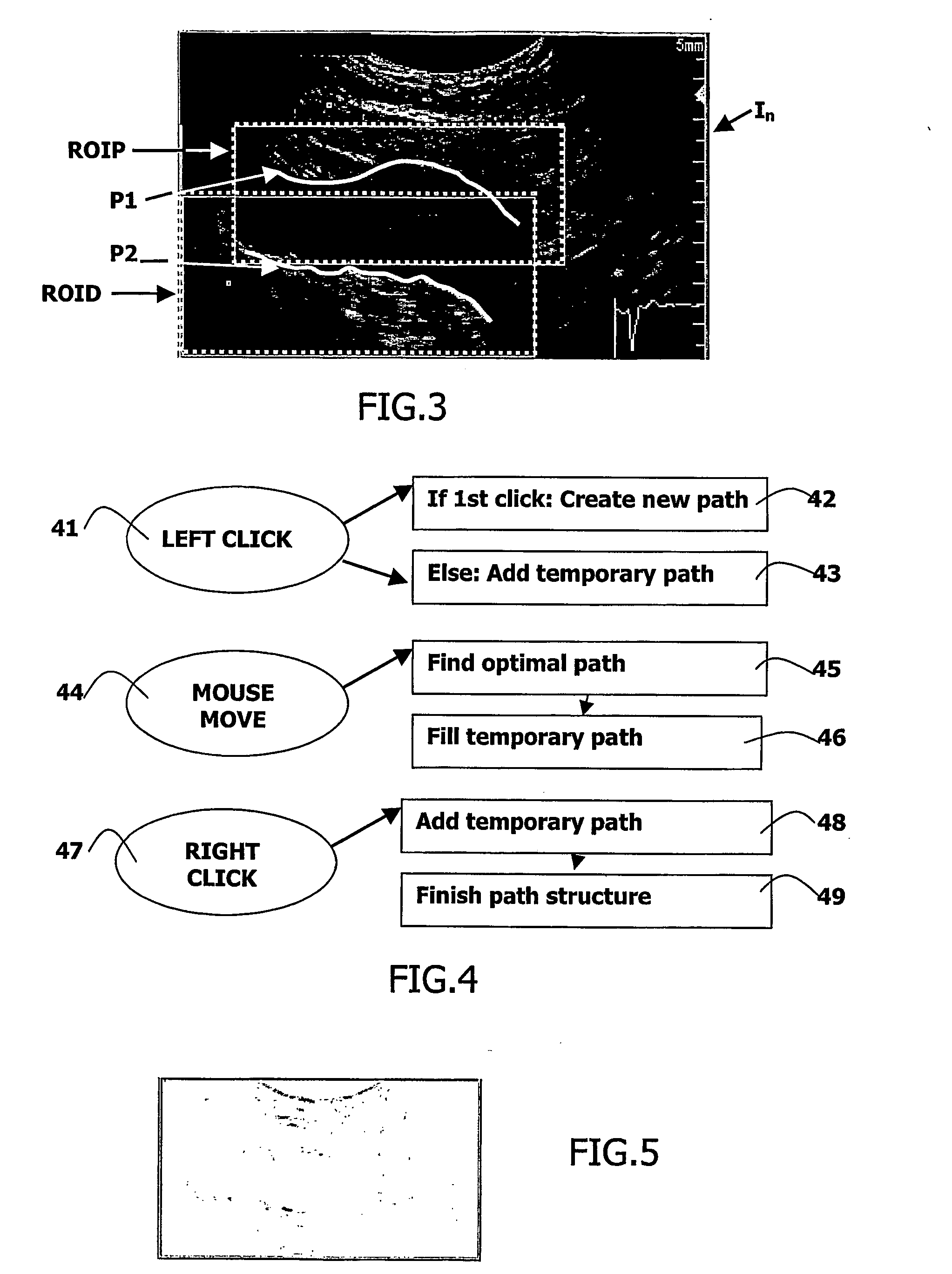 Ultrasonic apparatus for estimating artery parameters