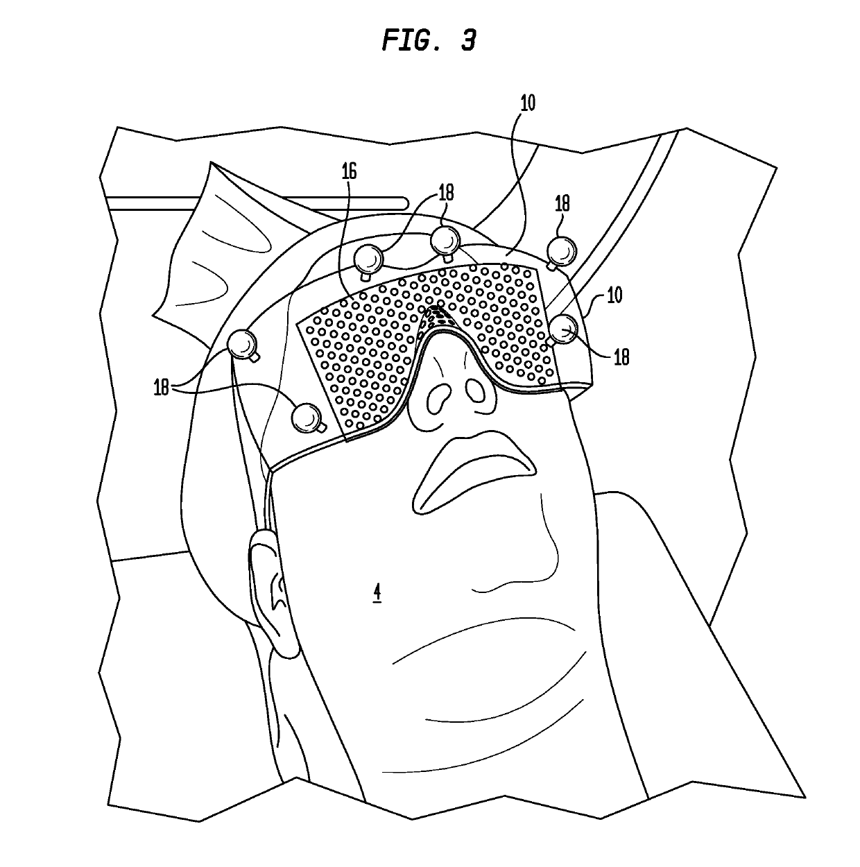 Cranial alignment device for use in intracranial stereotactic surgery