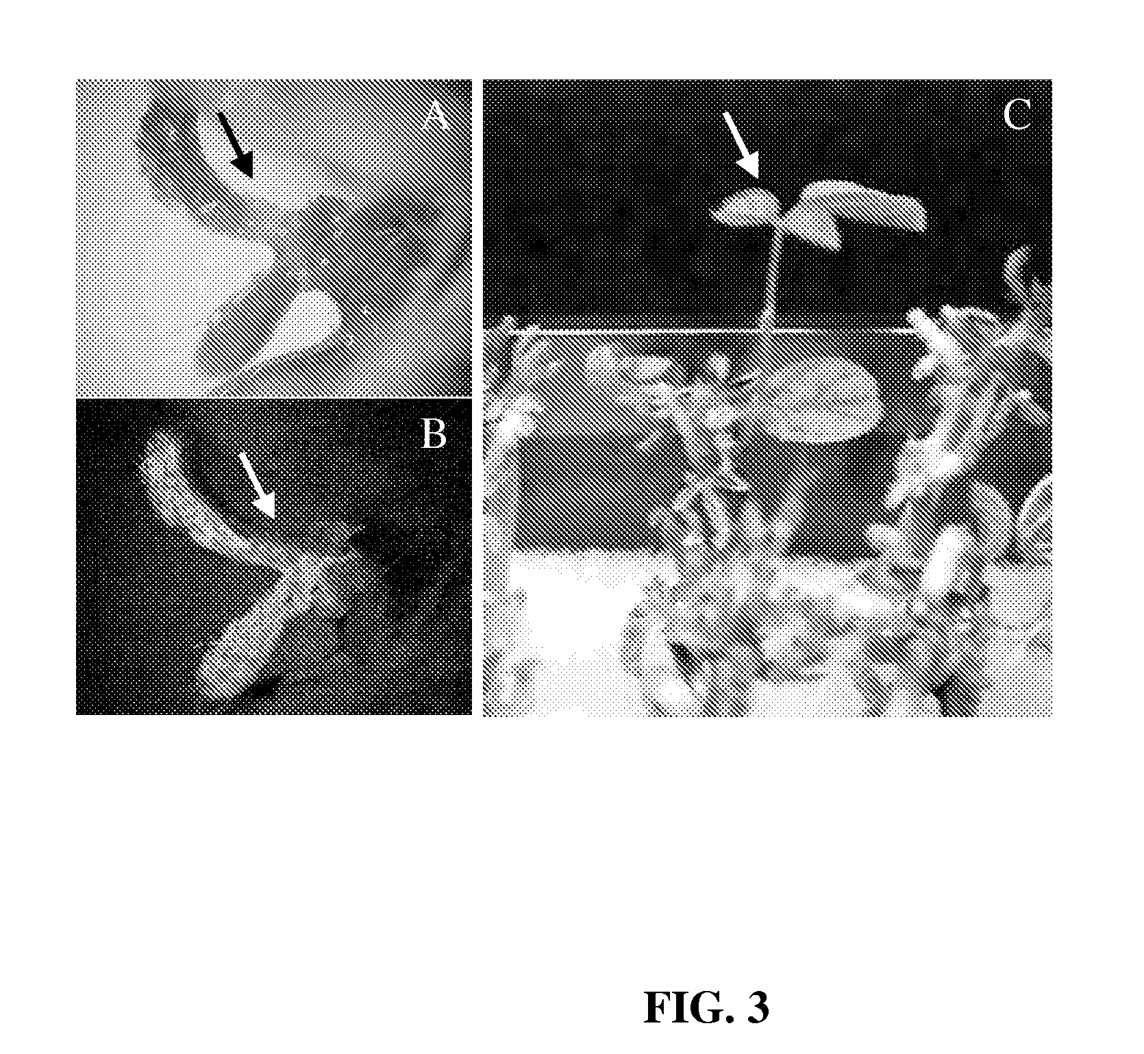 Method for selection of transformed cells