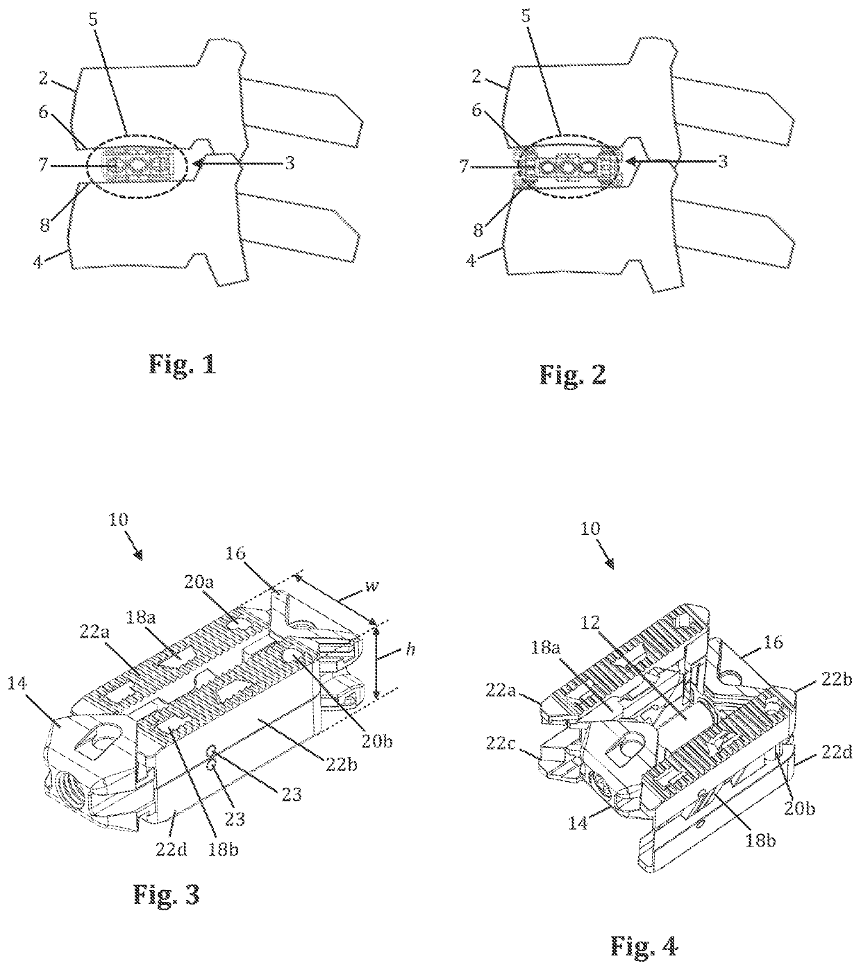 Expandable fusion device with interdigitating fingers