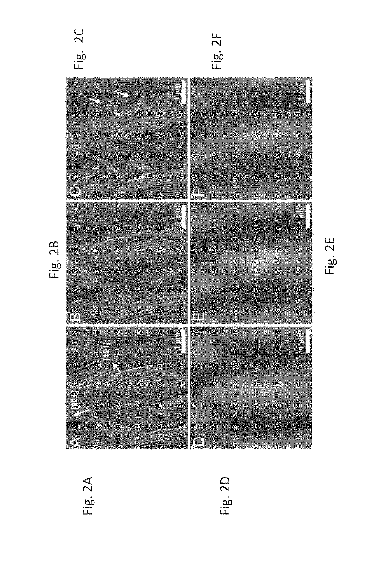 Organic acids as agents to dissolve calcium minerals in pathological calcification and uses thereof