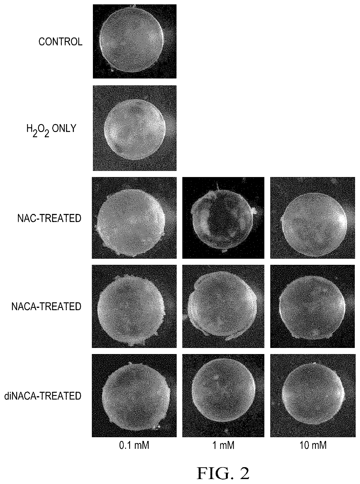 Prodrug for the treatment of disease and injury of oxidative stress