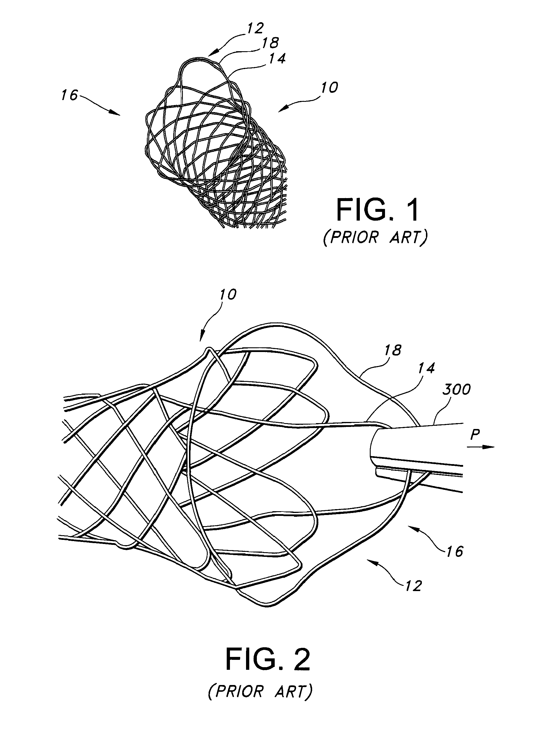 Integrated stent retrieval loop adapted for snare removal and/or optimized purse stringing