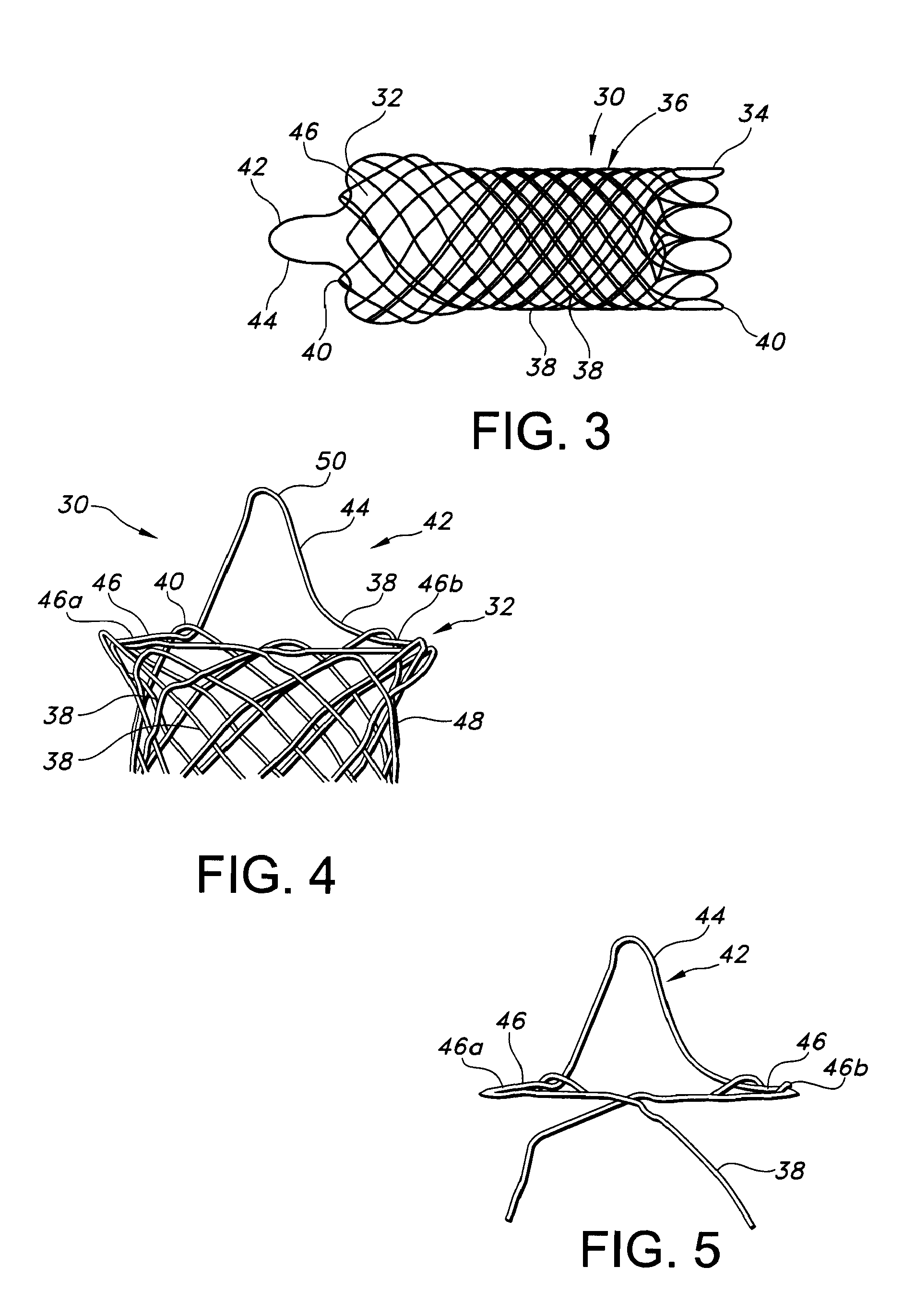 Integrated stent retrieval loop adapted for snare removal and/or optimized purse stringing