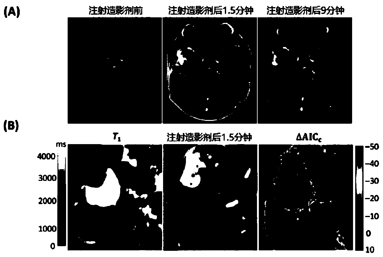 Analysis method of dynamic contrast-enhanced magnetic resonance image