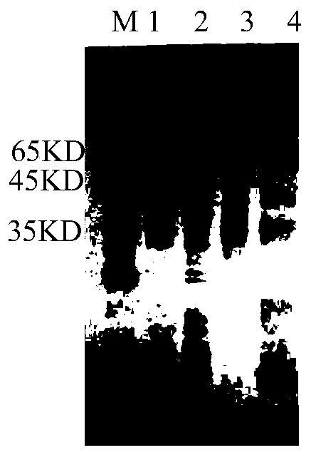 Hybridoma cell strain, monoclonal antibody with resistance of serine protease of trichinella spiralis in intestinal stage generated from hybridoma cell strain and application thereof