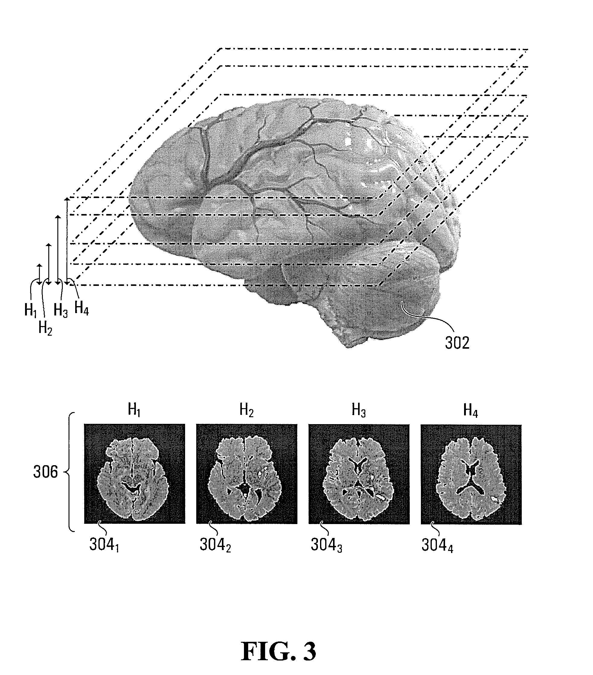 Method and system for processing multiple series of biological images obtained from a patient