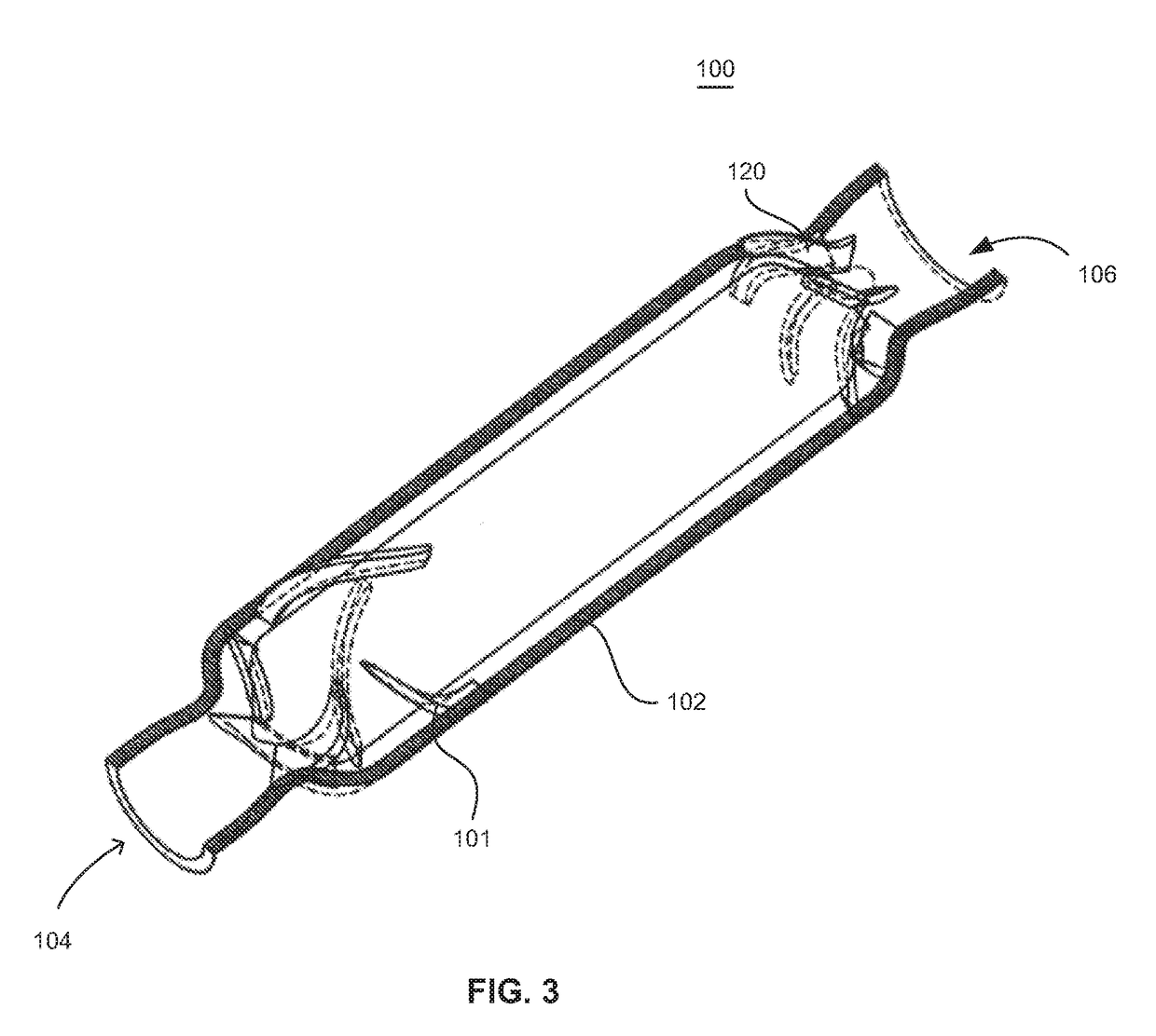 Blood pump with separate mixed-flow and axial-flow impeller stages and multi-stage stators