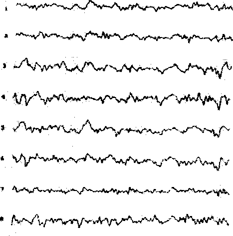 Method for forming brain scalp electric potential information chart