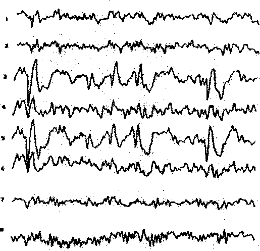 Method for forming brain scalp electric potential information chart