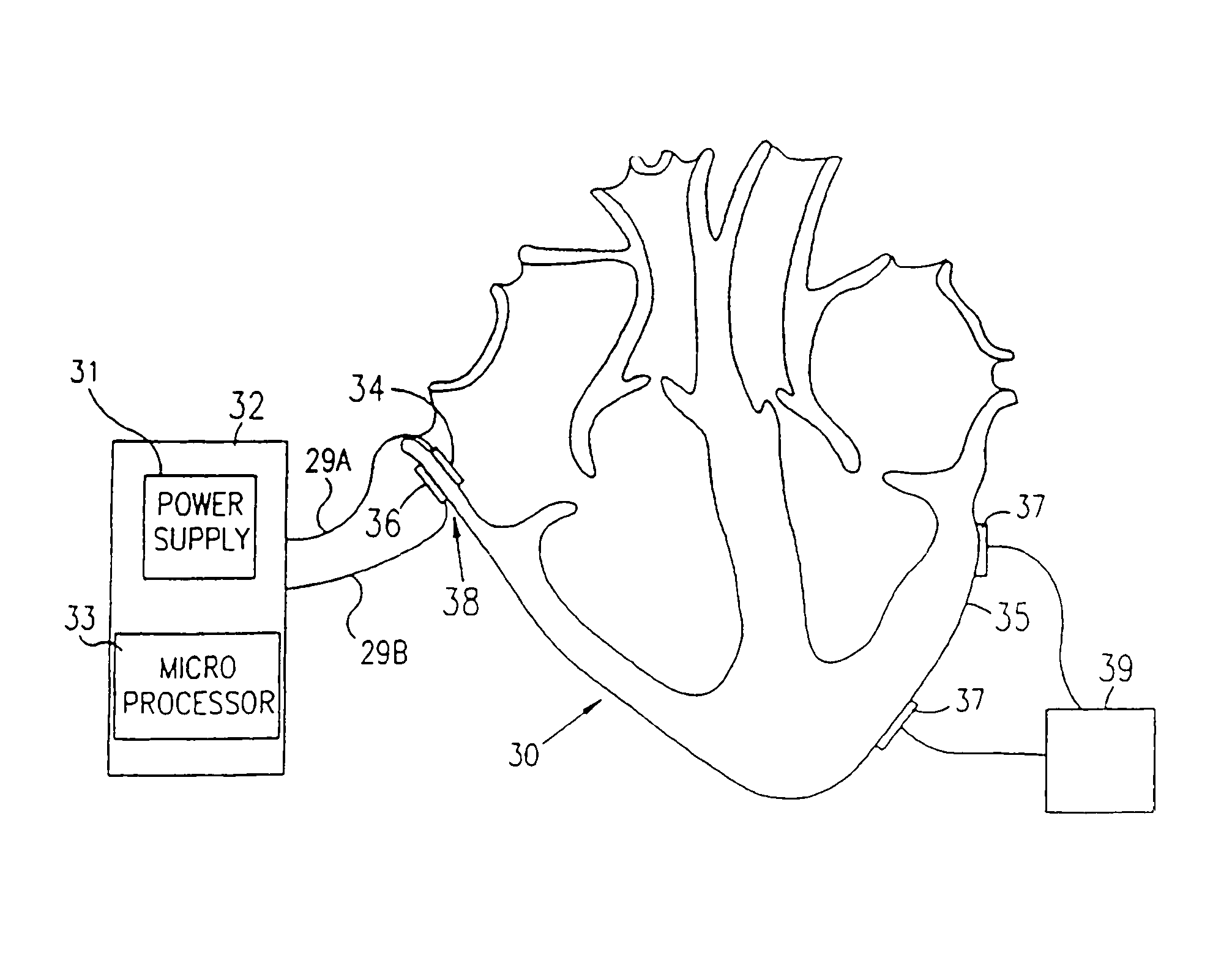 Electrical muscle controller