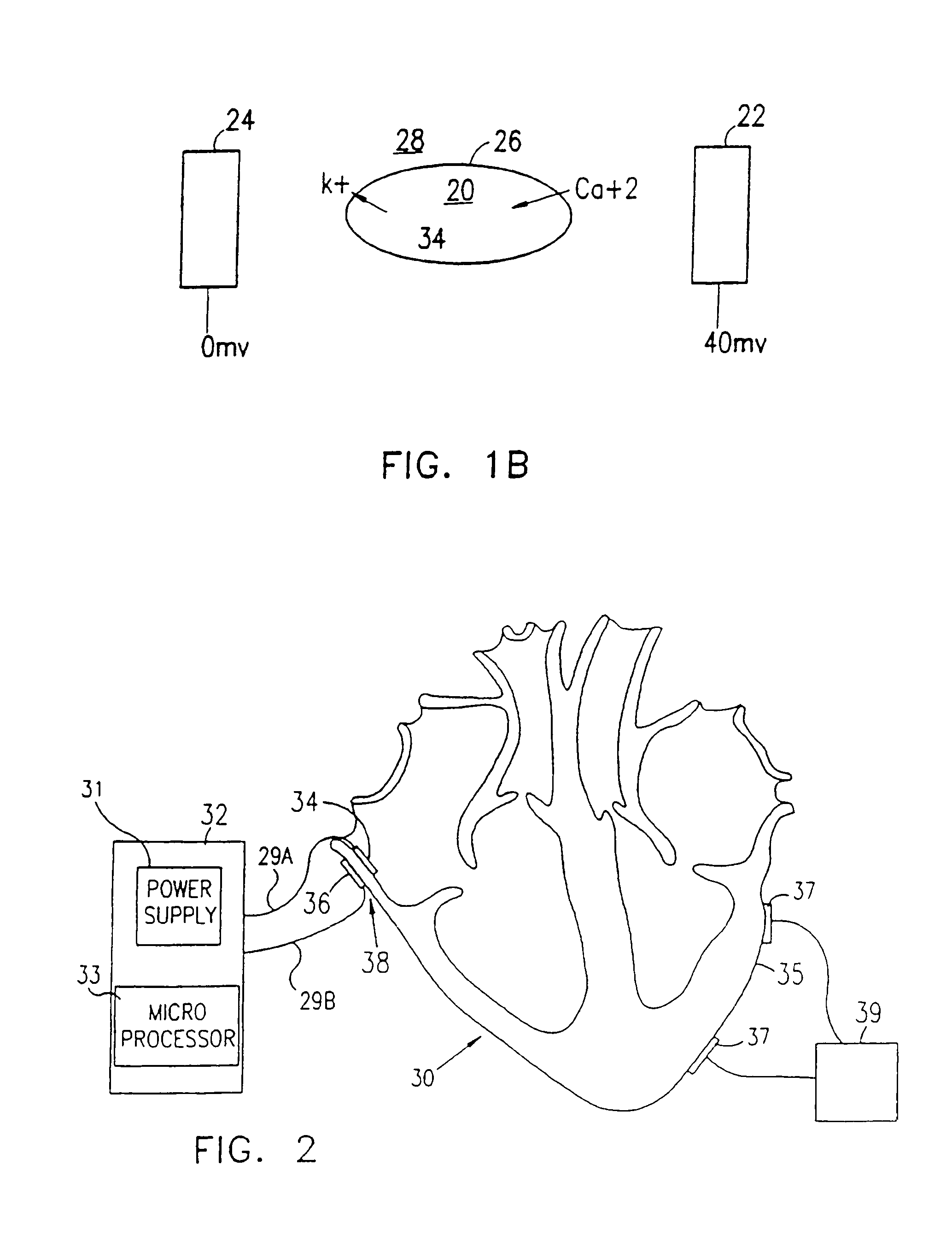 Electrical muscle controller