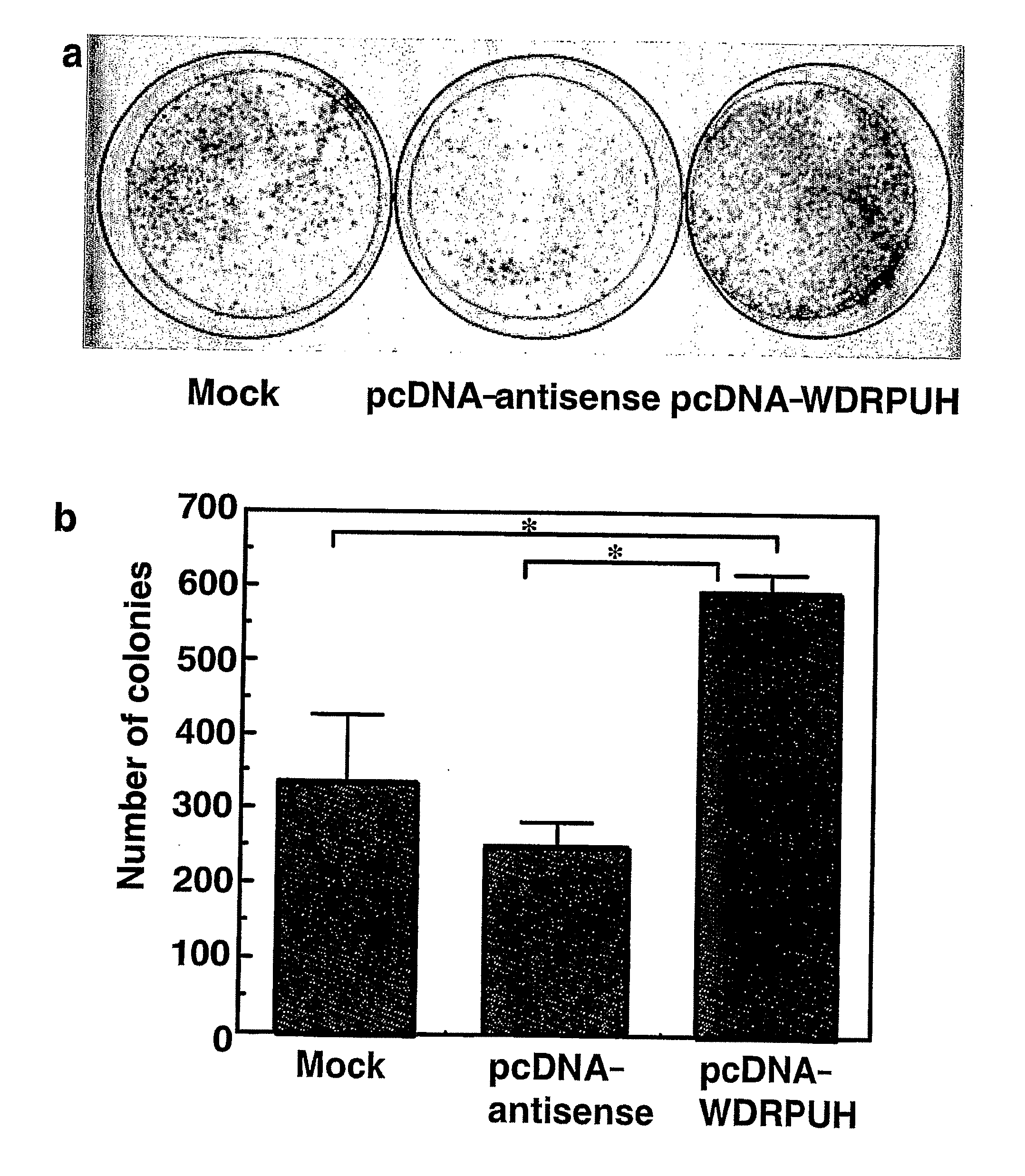 Genes and polypeptides relating to hepatocellular or colorectal carcinoma