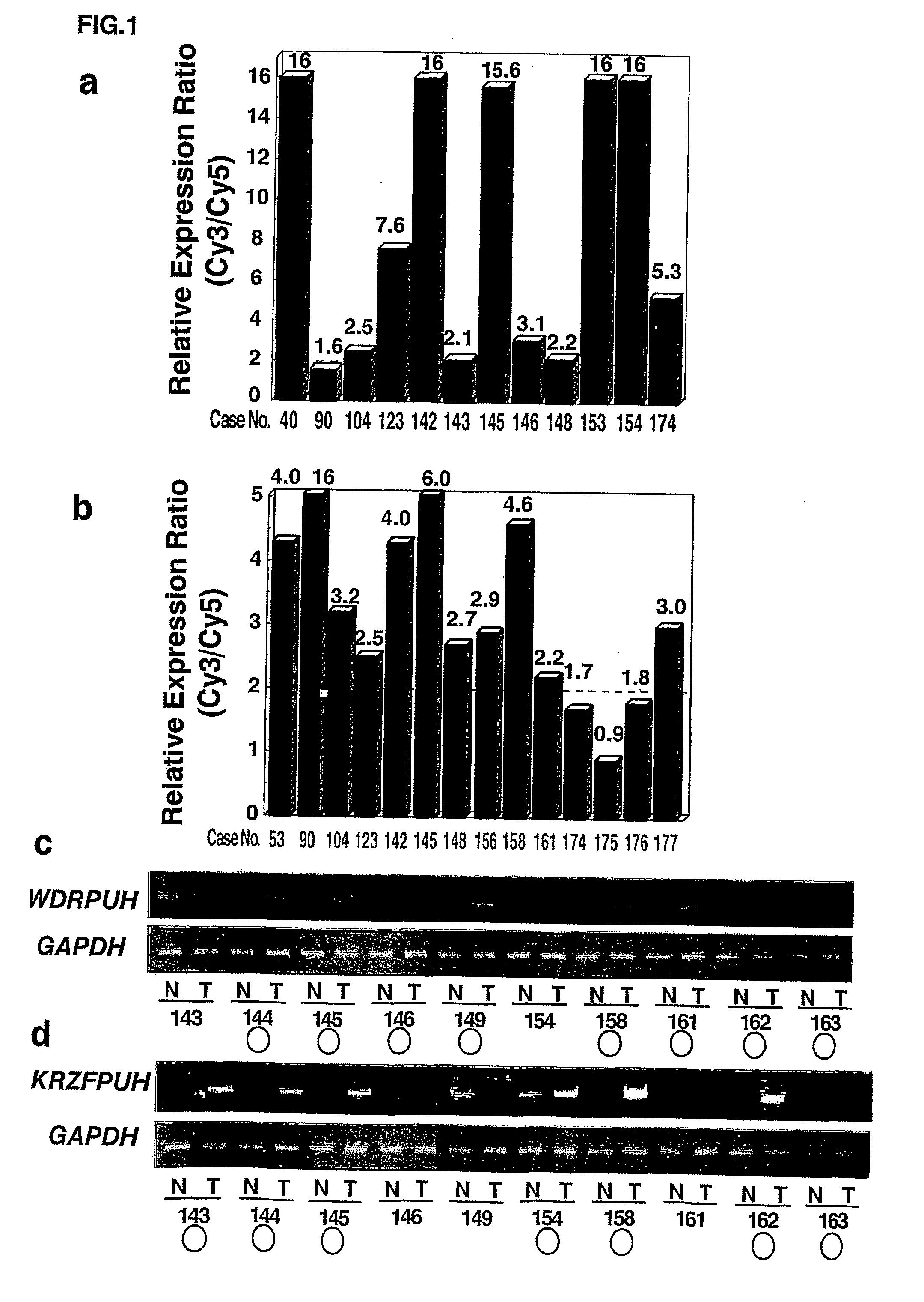 Genes and polypeptides relating to hepatocellular or colorectal carcinoma