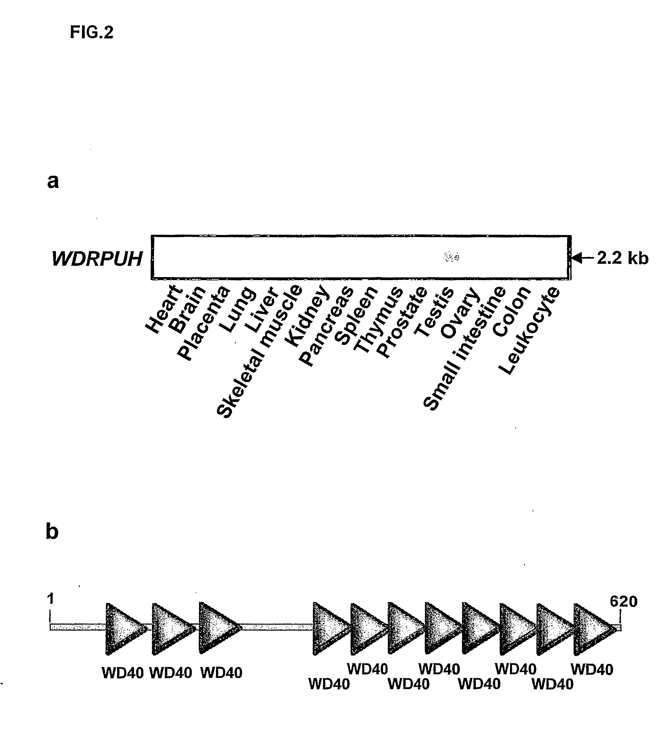 Genes and polypeptides relating to hepatocellular or colorectal carcinoma