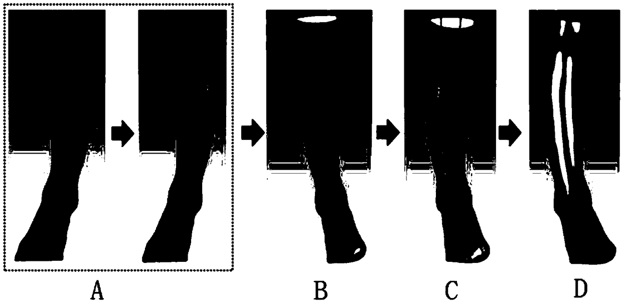 Method for light weight of 3D printing personalized external fixed supporting tool based on topology optimization