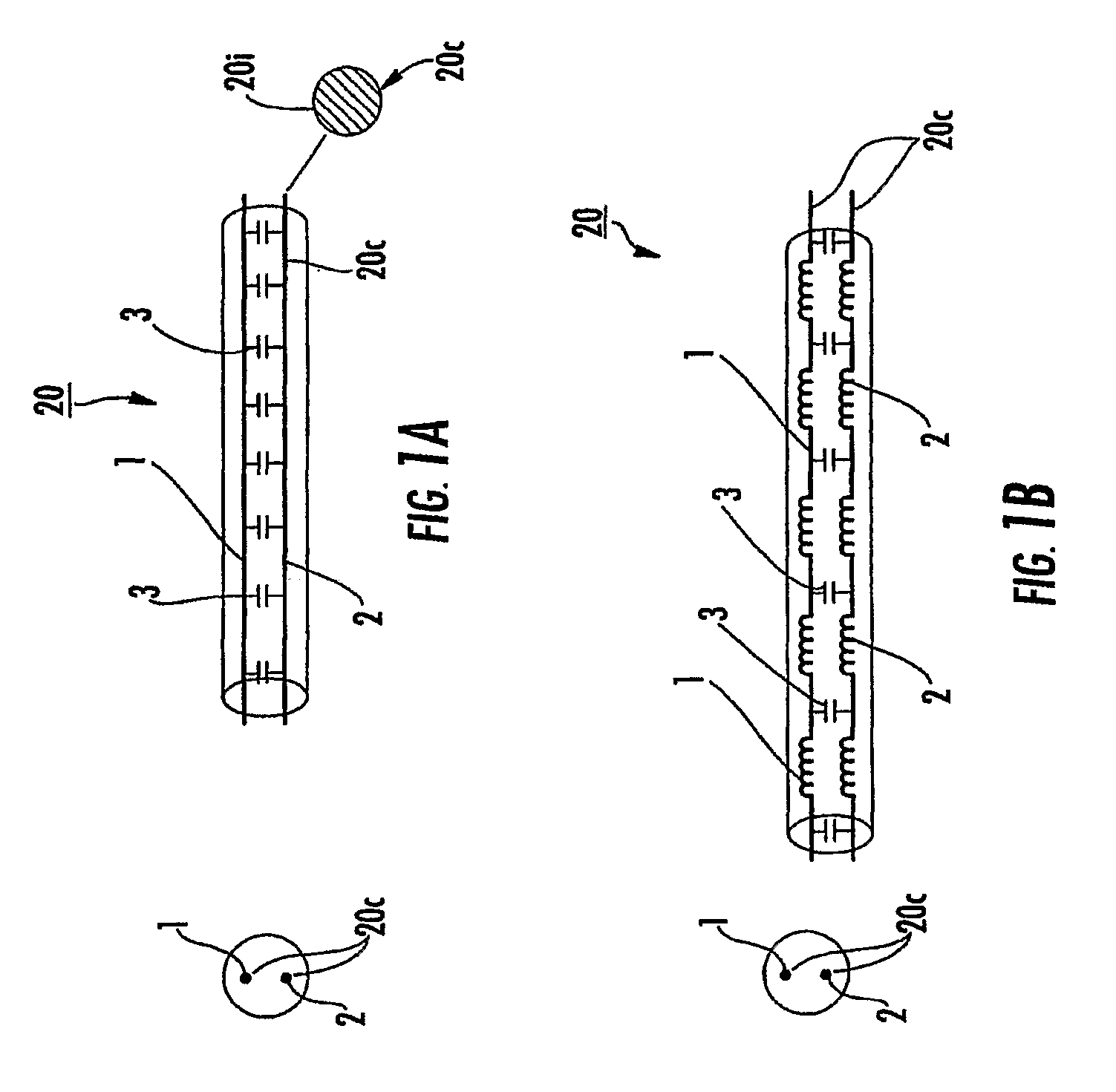 MRI-safe high impedance lead systems