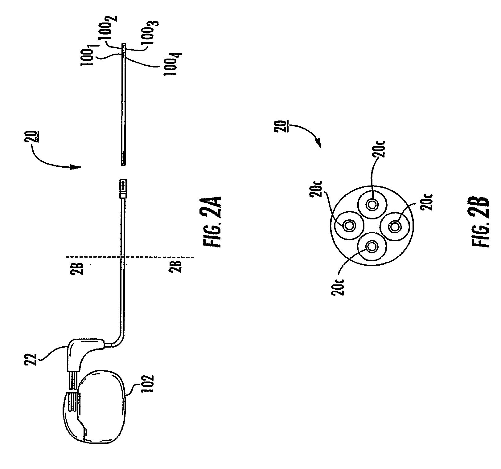 MRI-safe high impedance lead systems