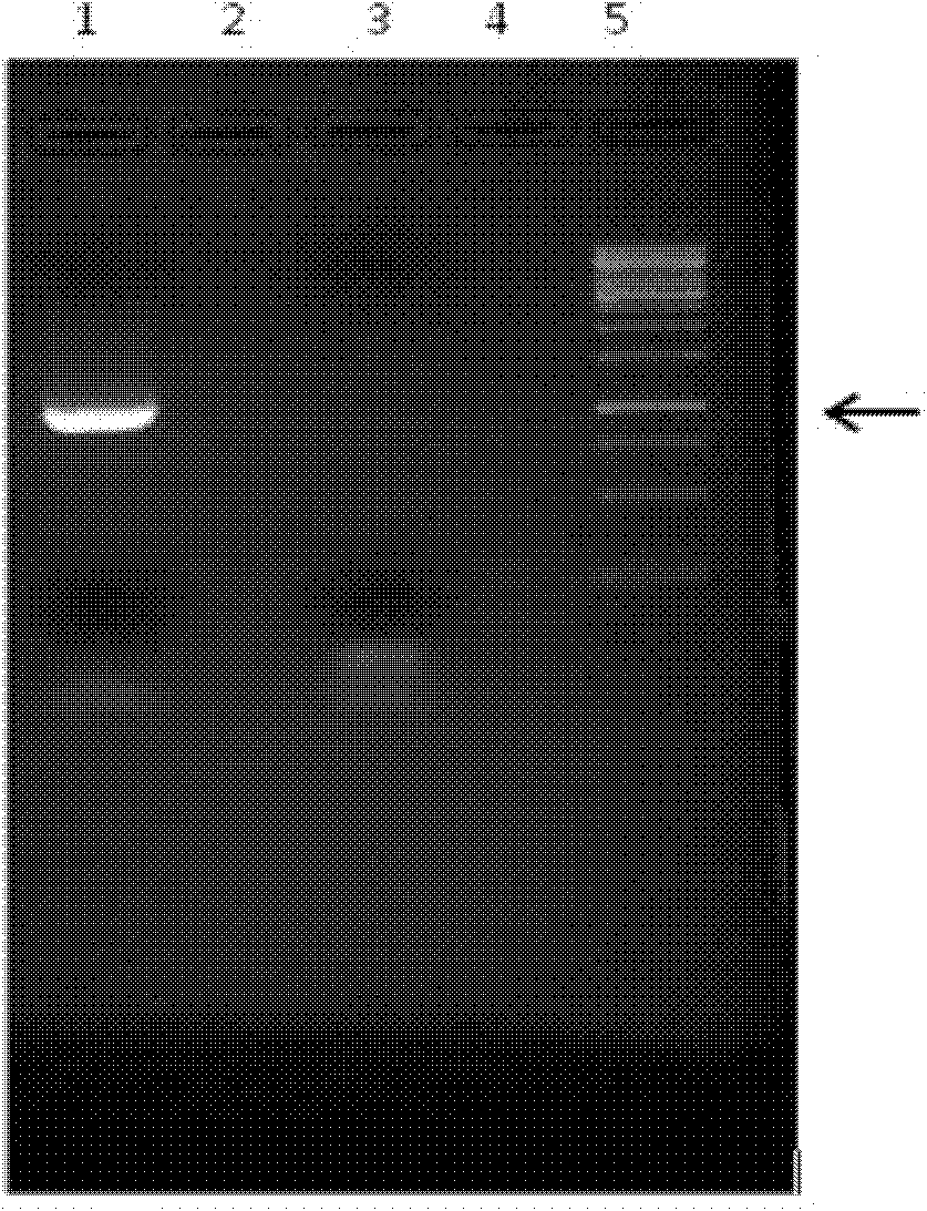 A method for preparing a recombinant Prevotella asparaginase