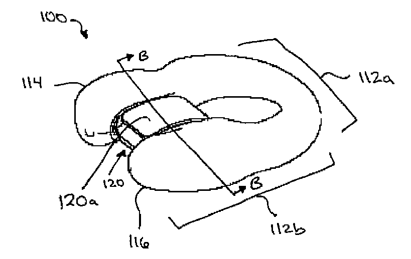 C-Shaped Disc Prosthesis