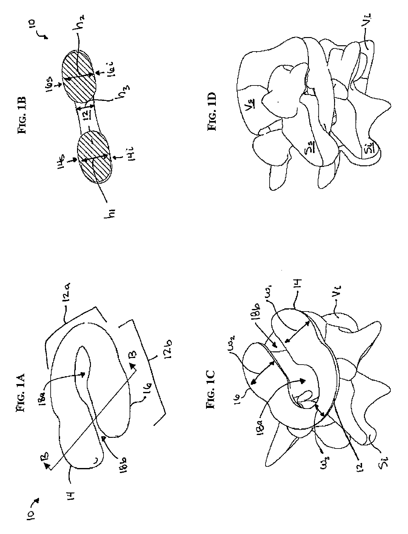 C-Shaped Disc Prosthesis