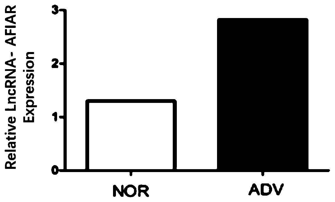 Application of long non coding RNA and interfering RNA thereof to treatment on atherosclerosis