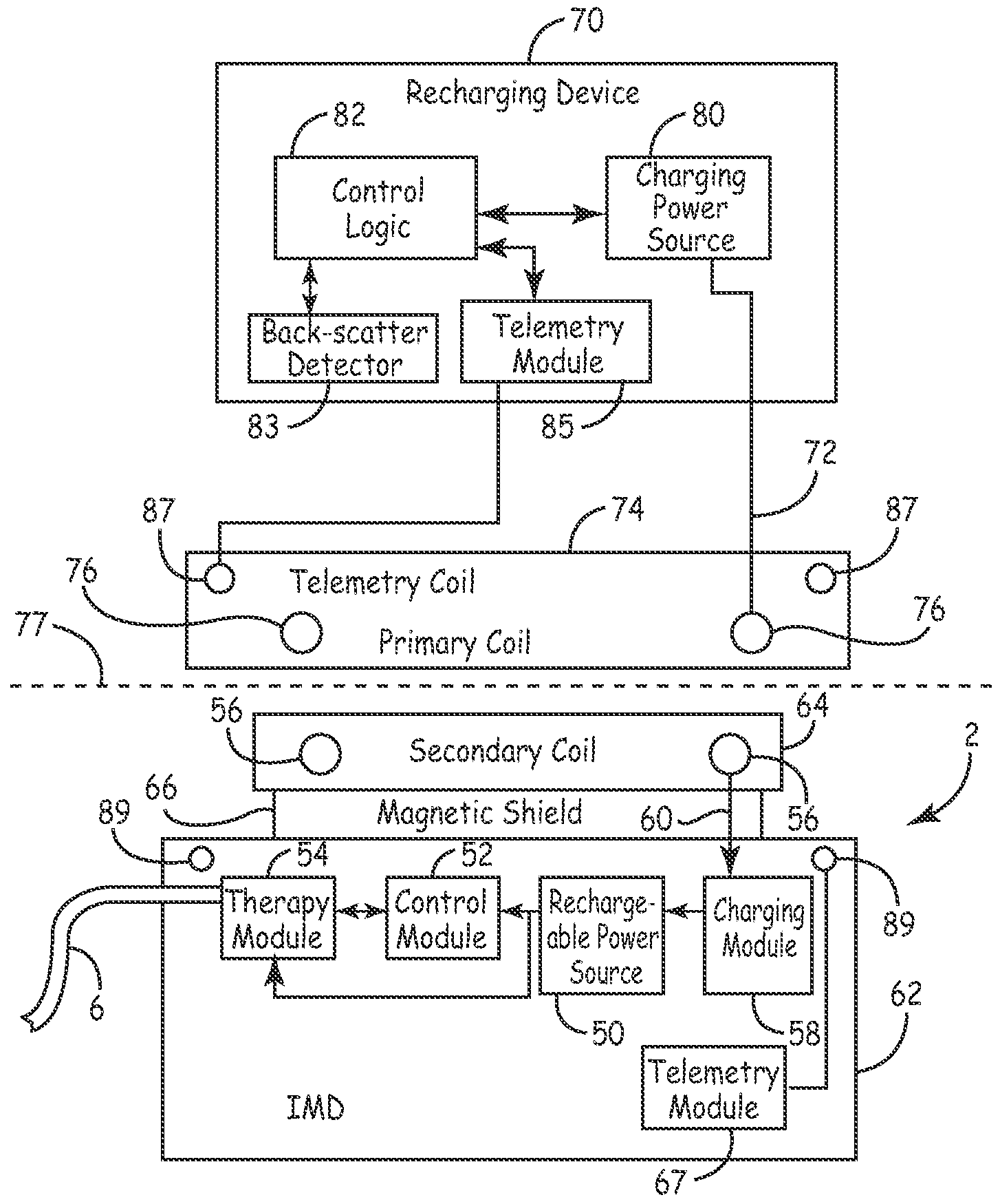 Hybrid rectification for recharging an implantable medical device