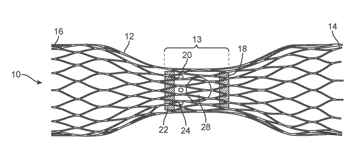 Vascular valve prosthesis