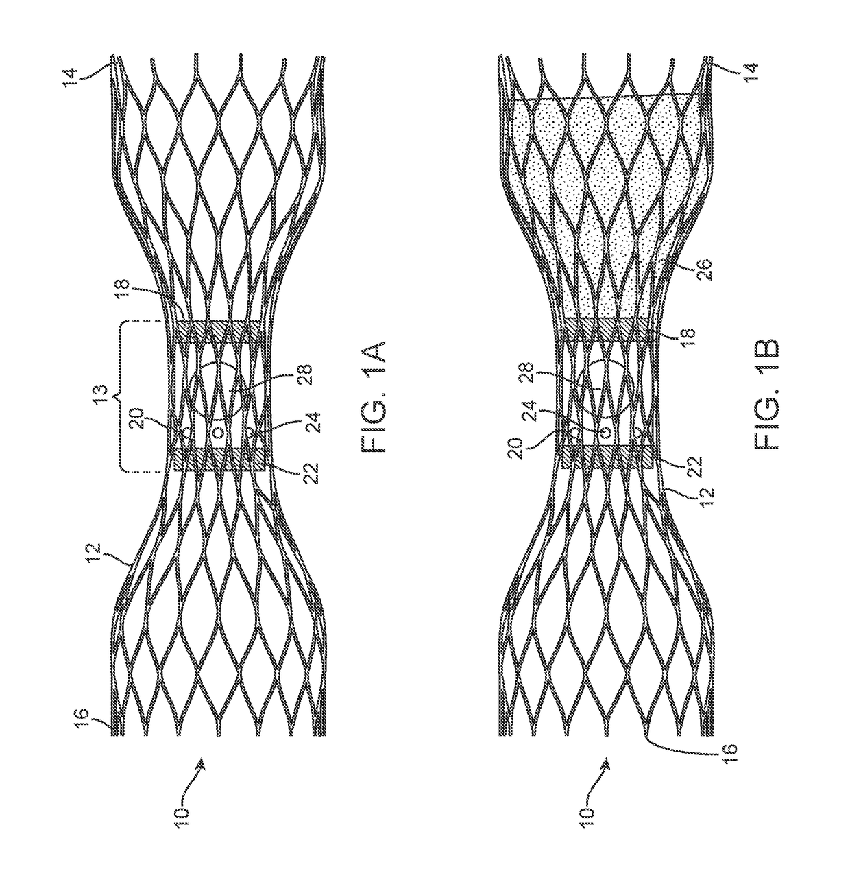 Vascular valve prosthesis